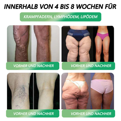 🏆🔥 Offizieller Shop|CVREOZ® DE🔥GLP-1 Sechs-in-Eins Gesundheitslösung Oralflüssigkeit (Nur einmal täglich, sichtbare Veränderungen in 7 Tagen)  ✅ Für Fettleibigkeit, Herz-Kreislauf-Gesundheit, Diabetes, Schlafapnoe, Darmgesundheit, Gelenkprobleme und mehr⭐